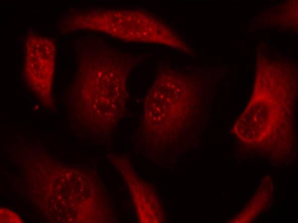 Anti-Phospho-FOXO3 (Ser253) Polyclonal Antibody 2