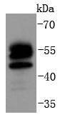 Anti-FOXO4 Antibody (2X512)