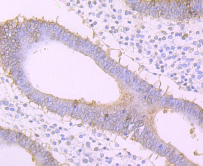 Anti-Frizzled-8 Antibody (5A651)