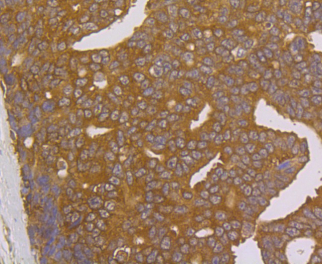 Anti-FKBP4 Antibody (1H771)