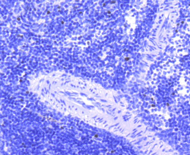 Anti-FOSB Antibody (8O342)