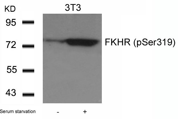 Anti-Phospho-FKHR (Ser319) Polyclonal Antibody