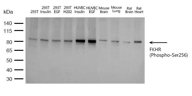 Anti-Phospho-FKHR (Ser256) Polyclonal Antibody