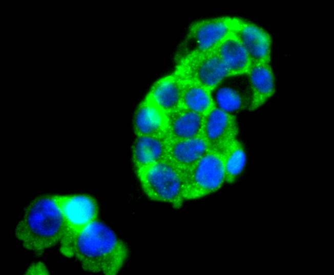 Anti-FOXO4 Antibody (5M471)