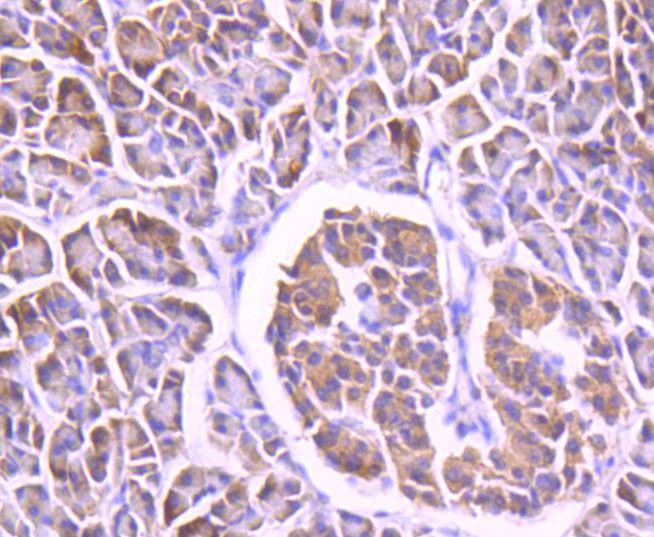 Anti-FOXO4 Antibody (2X512)