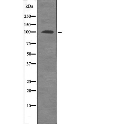Anti-Phospho-FOXO3 (Ser315) Polyclonal Antibody