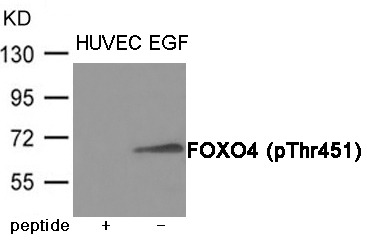 Anti-Phospho-FOXO4 (Thr451) Polyclonal Antibody