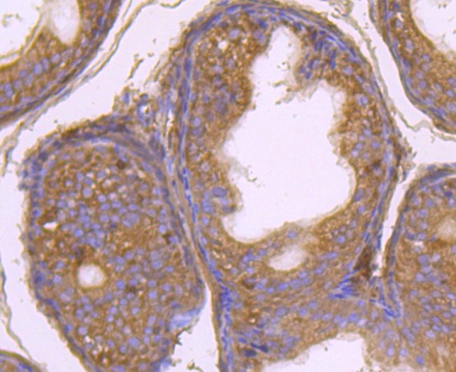 Anti-GAB1 Antibody (4I330)