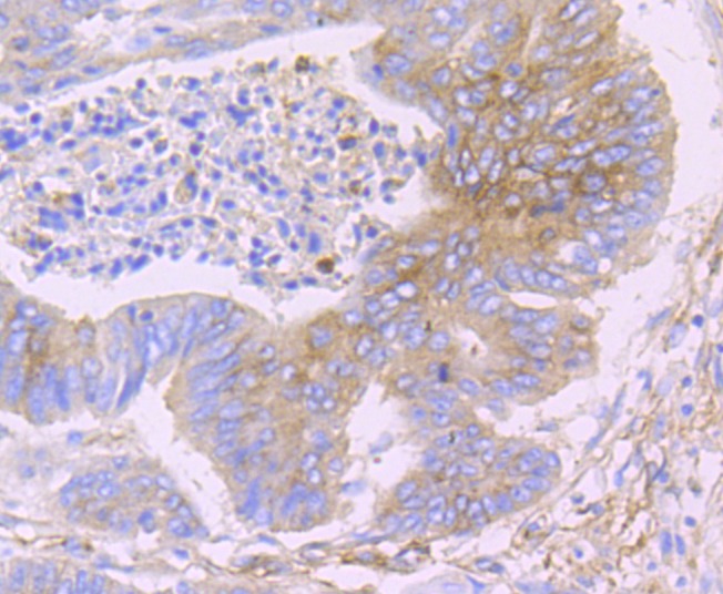 Anti-Fragilis/IFITM3 Antibody (5N399)