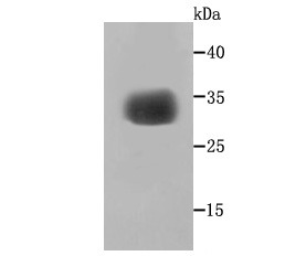 Anti-gamma Sarcoglycan Antibody (3H334)