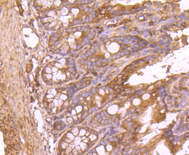 Anti-FASN Antibody (5Z147)