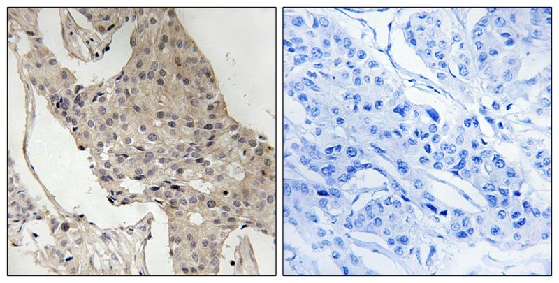 Anti-Phospho-GAB2 (Ser623) Polyclonal Antibody