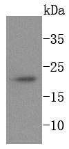 Anti-Ferritin light chain Antibody (6N112)