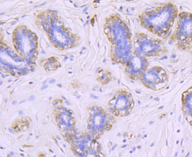 Anti-FGF-21 Antibody (3Q948)