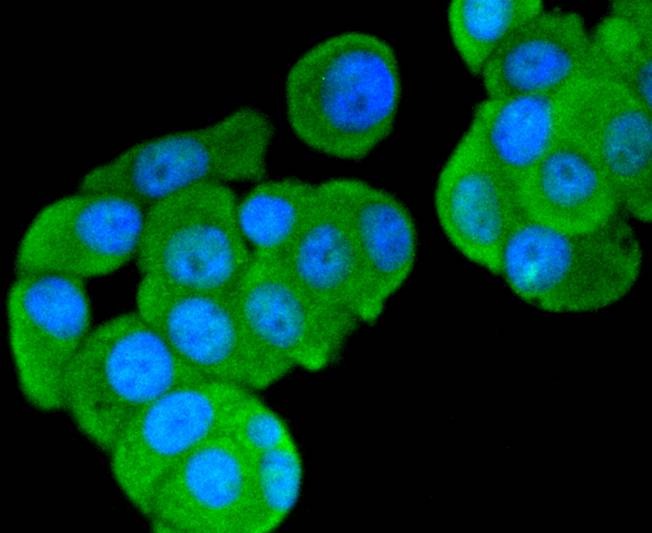 Anti-FOXO3 Antibody (6R502)