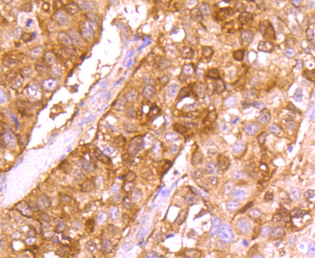 Anti-SNCG Antibody (8D869)