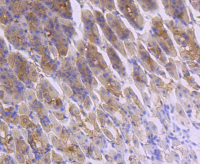 Anti-FGF-21 Antibody (3Q948)