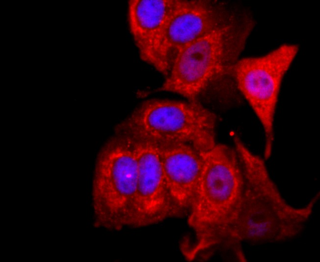 Anti-FOXP3 Antibody (1B572)
