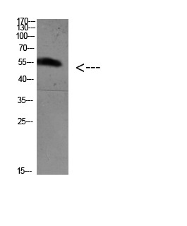 Anti-Acetyl-FOXO4 (Lys189) Polyclonal Antibody