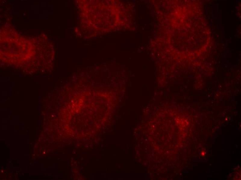 Anti-Phospho-GAB1 (Tyr627) Polyclonal Antibody