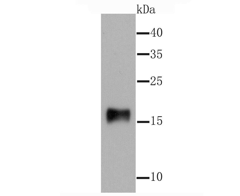 Anti-SNCG Antibody (8D869)