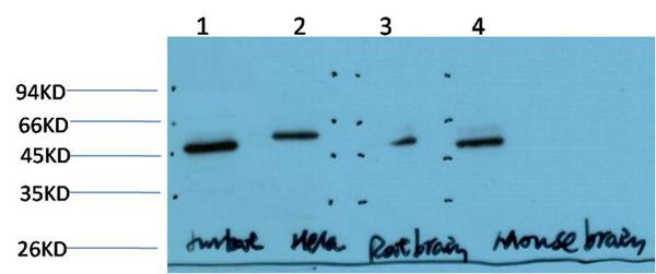 Anti-Gamma Tubulin Antibody (9N701)