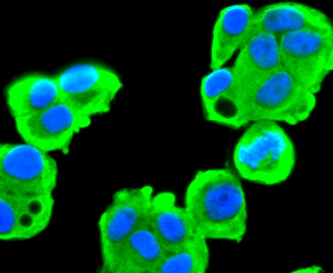 Anti-FASN Antibody (5Z147)