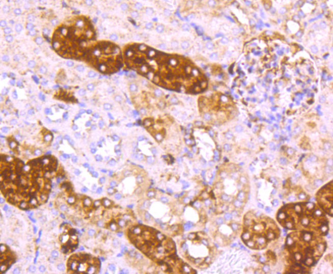 Anti-Ferritin light chain Antibody (9K512)