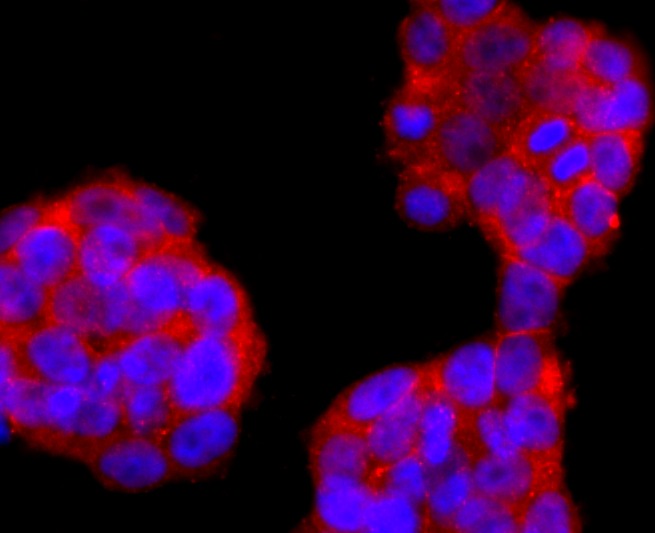 Anti-FOXP3 Antibody (1B572)