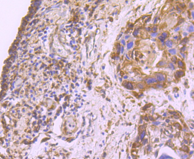 Anti-FASN Antibody (5Z147)