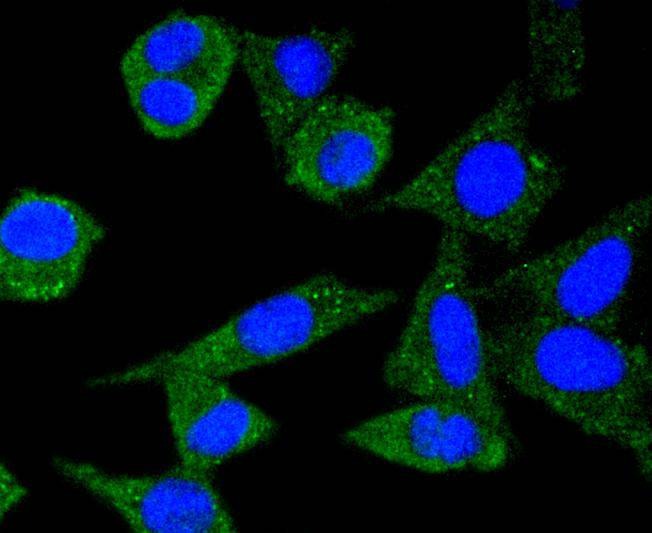 Anti-Ferritin light chain Antibody (6N112)