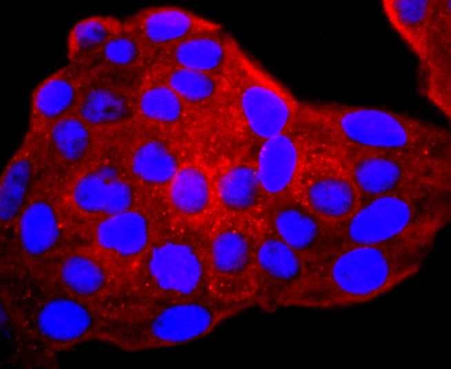 Anti-gamma Catenin Antibody (1O589)