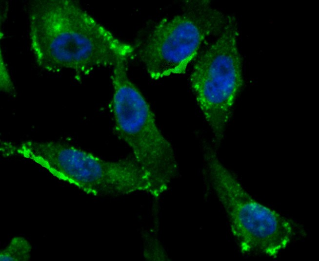 Anti-Fragilis/IFITM3 Antibody (5N399)
