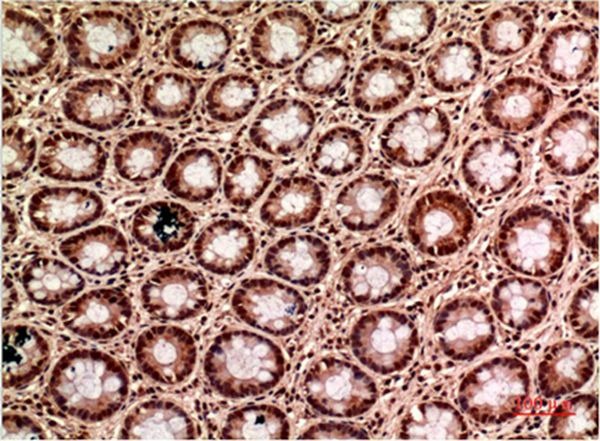 Anti-Gamma Tubulin Antibody (9N701)