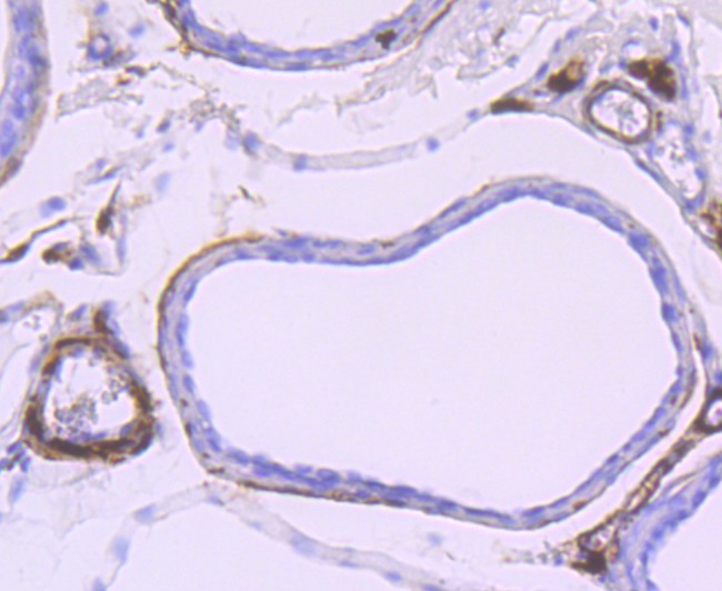 Anti-SNCG Antibody (8D869)