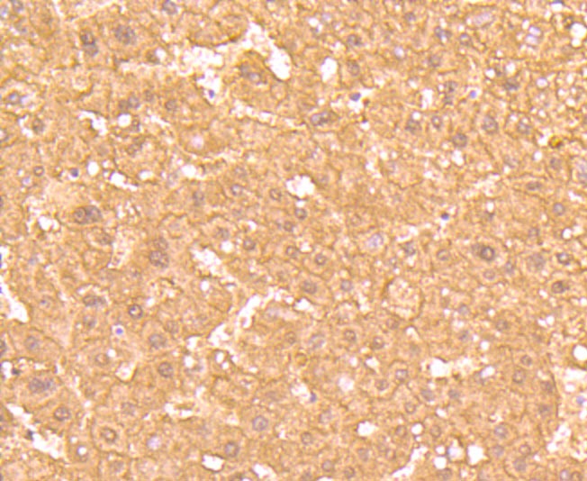 Anti-Ferritin light chain Antibody (9K512)