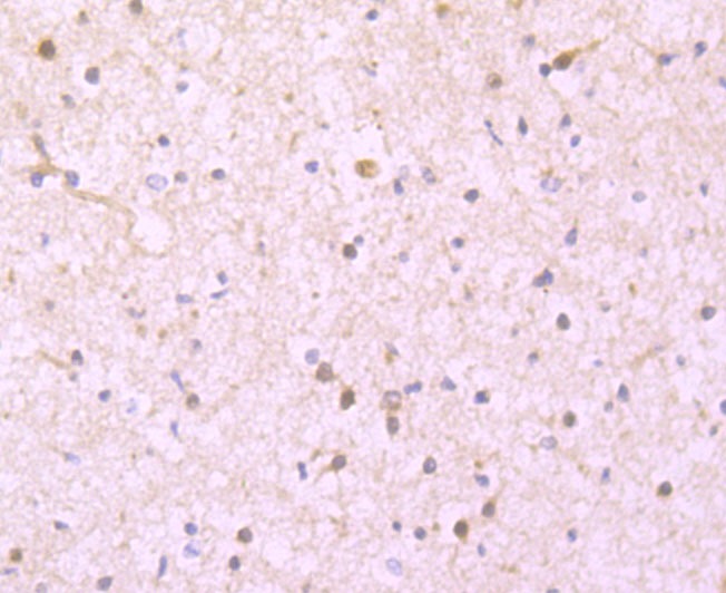 Anti-Ferritin light chain Antibody (9K512)