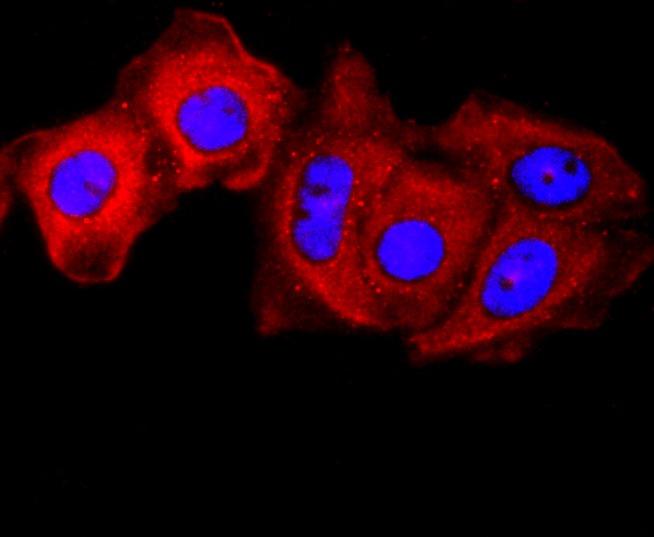 Anti-gamma Catenin Antibody (1O589)