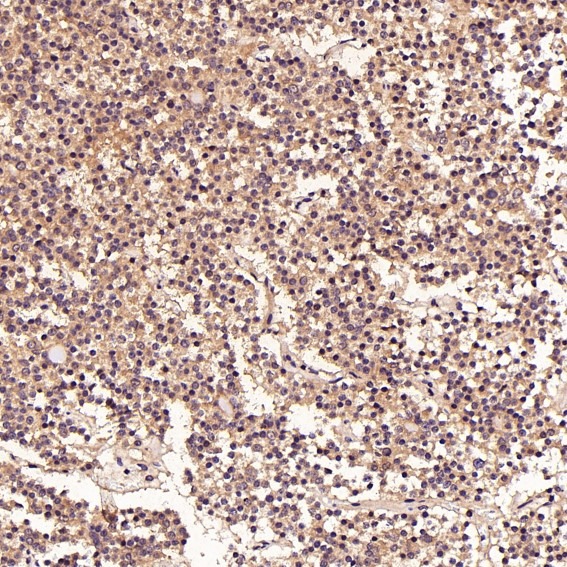 Anti-FGFR1 Antibody (9Z597)