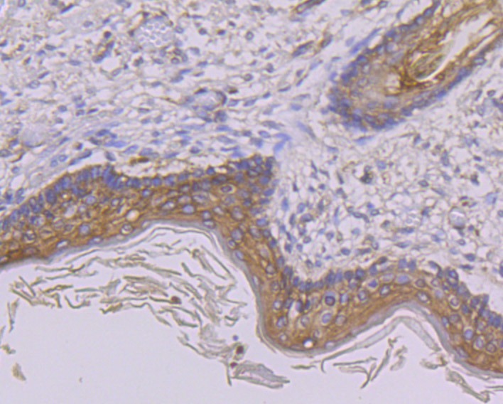 Anti-GAB1 Antibody (4I330)