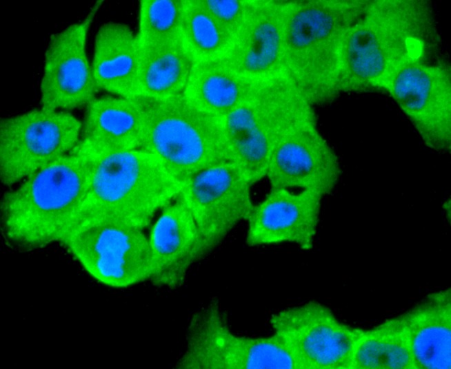 Anti-FASN Antibody (5Z147)
