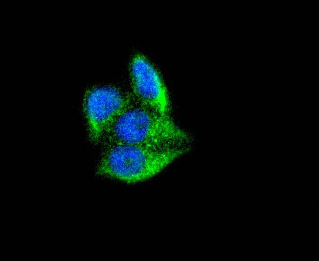 Anti-Ferritin light chain Antibody (6N112)