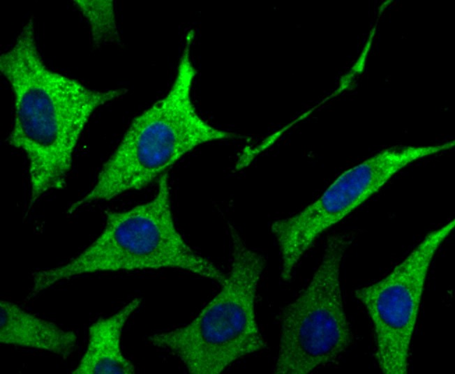 Anti-GAB1 Antibody (4I330)