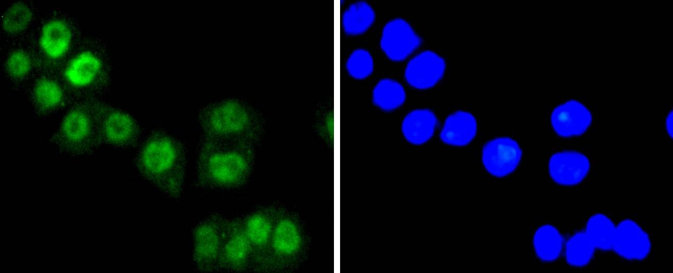 Anti-FOXO3 Antibody (6R502)