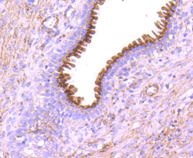 Anti-GOLM1 Antibody (8V618)