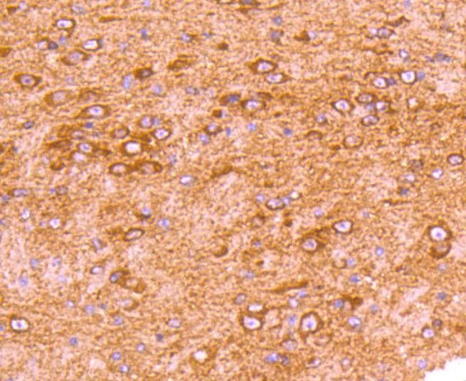 Anti-GRK2 Antibody (8P72)