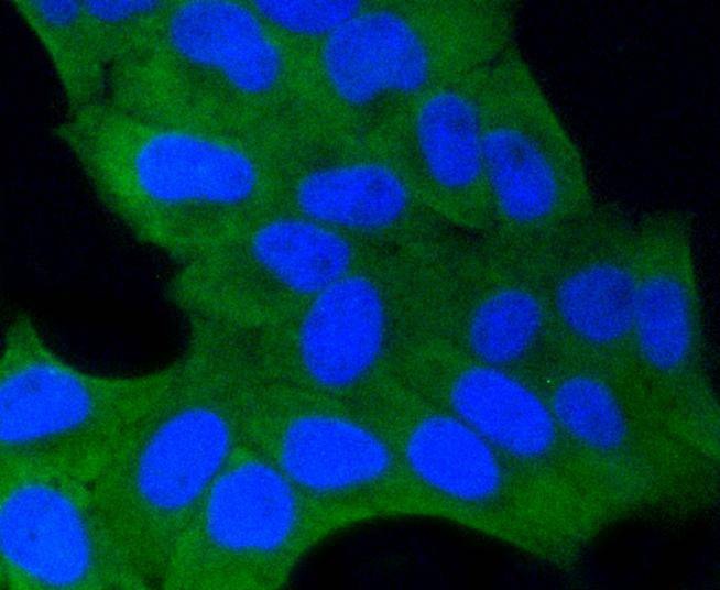 Anti-GSK3B Antibody (1A830)