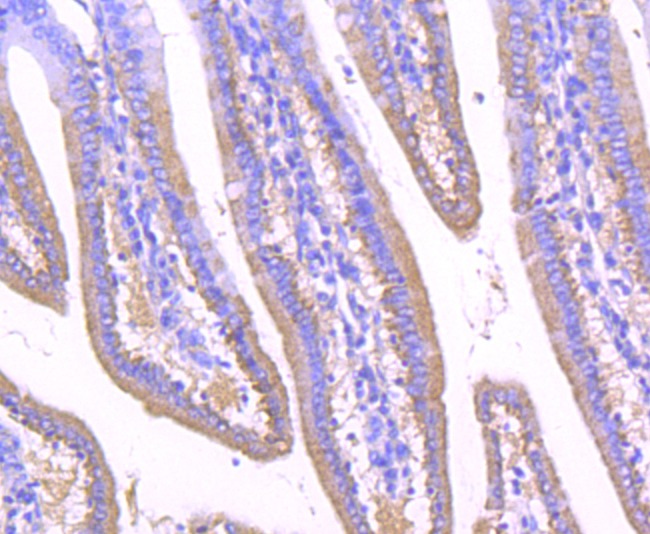 Anti-GOLM1 Antibody (8V618)