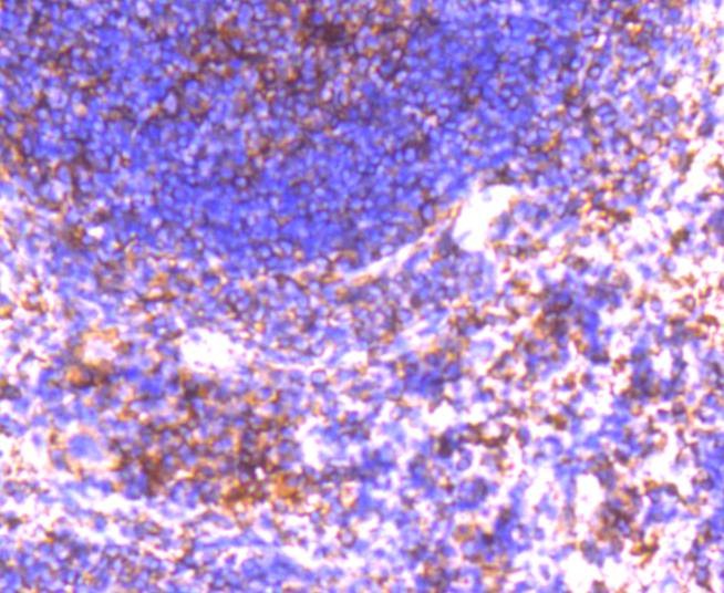 Anti-GRK2 Antibody (8P72)