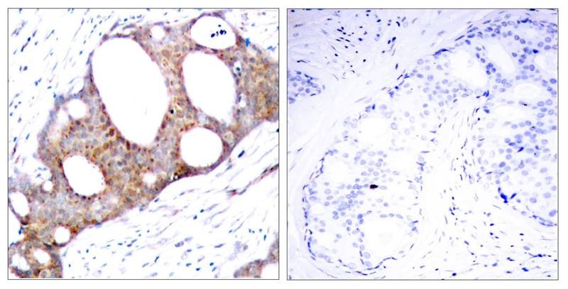 Anti-Phospho-GSK3A (Ser21) Polyclonal Antibody